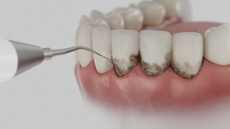 Reliable Dental contractor in West Carson, CA by Smile Center Dentistry